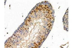 Phospho-IRF7 (Ser439) Antibody at 1/100 staining Mouse testis tissue by IHC-P.