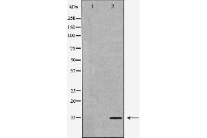 Western blot analysis of Mouse liver tissue lysates, using SPINLW1 Antibody. (Eppin antibody  (C-Term))