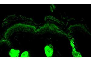 Immunohistochemistry analysis using Rabbit Anti-Calreticulin Polyclonal Antibody . (Calreticulin antibody  (Atto 594))