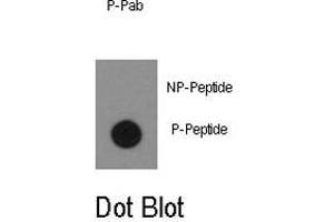 Dot blot analysis of ABL1 (phospho Y134) polyclonal antibody  on nitrocellulose membrane. (ABL1 antibody  (pTyr134))