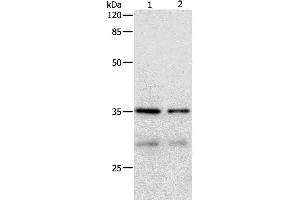 Western Blotting (WB) image for anti-Cyclin-Dependent Kinase 4 (CDK4) antibody (ABIN2427935) (CDK4 antibody)
