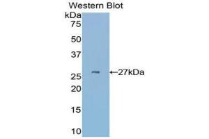 Western Blotting (WB) image for anti-Cysteine-Rich, Angiogenic Inducer, 61 (CYR61) (AA 176-379) antibody (ABIN3203381) (CYR61 antibody  (AA 176-379))