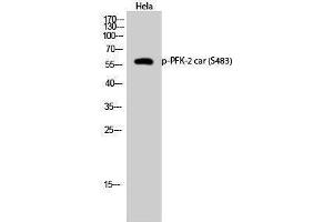 Western Blotting (WB) image for anti-6-phosphofructo-2-Kinase/fructose-2,6-Biphosphatase 2 (PFKFB2) (pSer483) antibody (ABIN3173263) (PFKFB2 antibody  (pSer483))