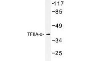 Western blot analysis of TFIIA-α antibody in extracts from RAW264. (GTF2A1 antibody)
