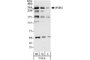 anti-Inositol 1,4,5-Trisphosphate Receptor, Type 3 (ITPR3) (AA 1755-1825) antibody