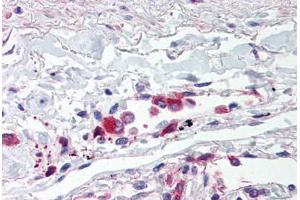 Human Lung, Alveolar Macrophages (formalin-fixed, paraffin-embedded) stained with TLR5 antibody ABIN214528 at 5 ug/ml followed by biotinylated goat anti-rabbit IgG secondary antibody ABIN481713, alkaline phosphatase-streptavidin and chromogen. (TLR5 antibody  (Internal Region))