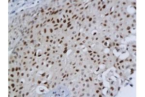 DBC1 antibody  (AA 101-200)