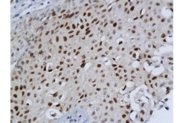 DBC1 antibody  (AA 101-200)