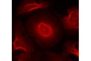 Immunofluorescence staining of methanol-fixed HeLa cells using GRIN2B polyclonal antibody (Cat # PAB12211, Red). (GRIN2B antibody  (Tyr1474))