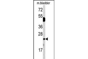 Western blot analysis of DUSP14 antibody (N-term) (ABIN392877 and ABIN2842285) in mouse bladder tissue lysates (35 μg/lane). (DUSP14 antibody  (N-Term))
