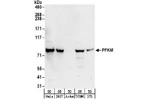 Western Blotting (WB) image for anti-phosphofructokinase, Muscle (PFKM) (AA 730-780) antibody (ABIN7450558)