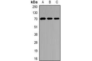 Western blot analysis of Kv4. (KCND2 antibody)