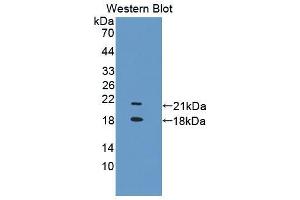 Western blot analysis of the recombinant protein. (TRPV6 antibody  (AA 578-725))