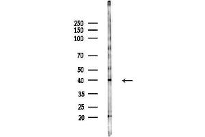anti-Succinate Receptor 1 (SUCNR1) (Internal Region) antibody