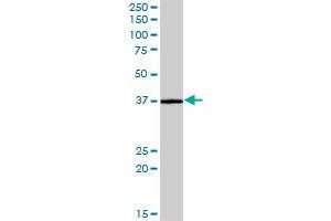 CRELD2 MaxPab polyclonal antibody. (CRELD2 antibody  (AA 1-321))