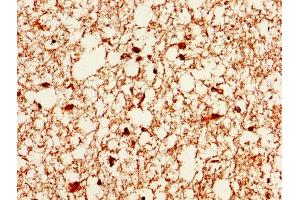 IHC image of ABIN7146715 diluted at 1:400 and staining in paraffin-embedded human brain tissue performed on a Leica BondTM system. (CA2 antibody  (AA 2-260))