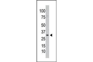 Image no. 1 for anti-Protein Phosphatase 1, Catalytic Subunit, gamma Isoform (PPP1CC) (C-Term) antibody (ABIN360760) (PPP1CC antibody  (C-Term))