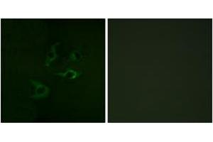 Immunofluorescence (IF) image for anti-Cas-Br-M (Murine) Ecotropic Retroviral Transforming Sequence (CBL) (AA 740-789) antibody (ABIN2888650) (CBL antibody  (AA 740-789))