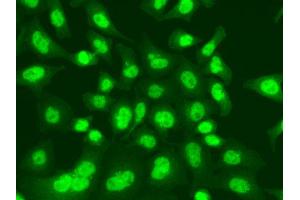 Immunofluorescence analysis of A549 cell using LIG1 antibody. (LIG1 antibody)
