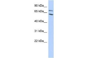 Western Blotting (WB) image for anti-Metastasis Associated 1 Family, Member 2 (MTA2) antibody (ABIN2458168) (MTA2 antibody)