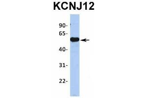 Host:  Rabbit  Target Name:  KCNJ12  Sample Type:  Human Fetal Brain  Antibody Dilution:  1. (Kir2.2 antibody  (Middle Region))