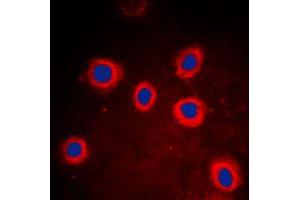 Immunofluorescent analysis of Cytokeratin 8 staining in DLD cells. (KRT8 antibody  (Center))
