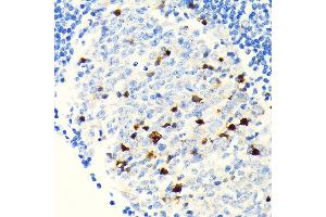 Immunohistochemistry of paraffin-embedded human appendix using Parvalbumin (PVALB) (PVALB) Rabbit mAb (ABIN7269182) at dilution of 1:100 (40x lens). (PVALB antibody)