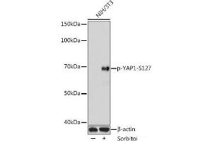 Western blot analysis of extracts of NIH3T3 cells using Phospho-YAP1(S127) Polyclonal Antibody at dilution of 1:1000.