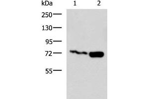Western blot analysis of Jurkat and Raji cell lysates using PUM3 Polyclonal Antibody at dilution of 1:800 (Pumilio 3 antibody)