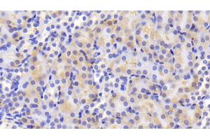 Detection of ACO1 in Mouse Kidney Tissue using Polyclonal Antibody to Aconitase 1 (ACO1) (Aconitase 1 antibody  (AA 329-443))