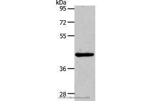 Western blot analysis of Hela cell, using MMP13 Polyclonal Antibody at dilution of 1:500 (MMP13 antibody)