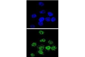 Confocal immunofluorescent analysis of MEF2A Antibody (Center) Cat. (MEF2A antibody  (Middle Region))