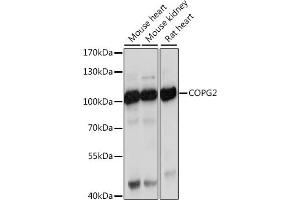 Western blot analysis of extracts of various cell lines, using COPG2 antibody (ABIN7266426) at 1:1000 dilution. (COPG2 antibody  (AA 542-871))