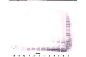 Image no. 2 for anti-gamma-Interferon-Induced Monokine (CXCL9) antibody (ABIN465139) (CXCL9 antibody)