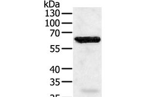Western Blot analysis of Jurkat cell using TRAF5 Polyclonal Antibody at dilution of 1:450 (TRAF5 antibody)