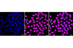 anti-Heterogeneous Nuclear Ribonucleoprotein C (C1/C2) (HNRNPC) antibody