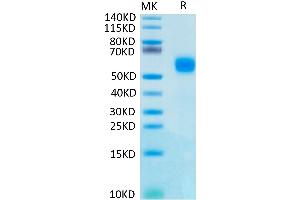 IL1R2 Protein (His tag)