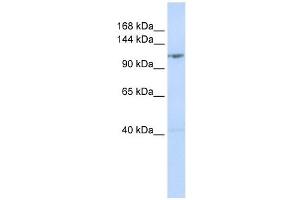 DDX46 antibody used at 1 ug/ml to detect target protein. (DDX46 antibody)