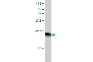 Western Blotting (WB) image for anti-Non-SMC Condensin I Complex, Subunit G (NCAPG) (AA 336-435) antibody (ABIN566241)