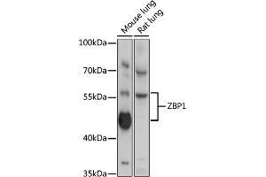 Western blot analysis of extracts of various cell line, using ZBP1 antibody (ABIN6128935, ABIN6150365, ABIN6150367 and ABIN6218066) at 1:3000 dilution. (ZBP1 antibody  (AA 1-200))
