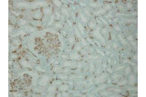 Immunohistochemistry (IHC) image for anti-Complement Component C4d (C4d) antibody (ABIN870587) (Complement C4d antibody)