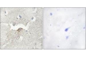 Immunohistochemistry analysis of paraffin-embedded human brain tissue, using LMTK2 Antibody. (LMTK2 antibody  (AA 651-700))