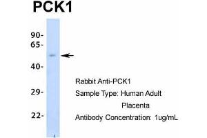 Western Blotting (WB) image for anti-phosphoenolpyruvate Carboxykinase 1 (Soluble) (PCK1) (Middle Region) antibody (ABIN2777603)