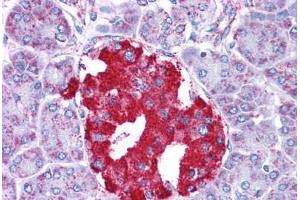 Immunohistochemistry (Formalin-fixed Paraffin-embedded Sections) (IHC (fp)) image for anti-Glutamate Dehydrogenase 1 (GLUD1) (AA 182-231) antibody (ABIN6745734)