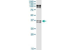 Immunoprecipitation of ELAVL1 transfected lysate using rabbit polyclonal anti-ELAVL1 and Protein A Magnetic Bead