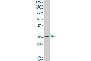 THTPA monoclonal antibody (M01), clone 3F6 Western Blot analysis of THTPA expression in A-431 .