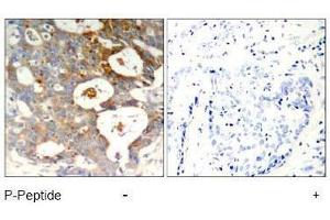 Image no. 1 for anti-Nuclear Factor of kappa Light Polypeptide Gene Enhancer in B-Cells Inhibitor, epsilon (NFKBIE) (pSer22) antibody (ABIN196949) (NFKBIE antibody  (pSer22))