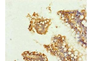 Immunohistochemistry of paraffin-embedded human small intestine tissue using ABIN7149102 at dilution of 1:100 (UQCRC1 antibody  (AA 156-480))