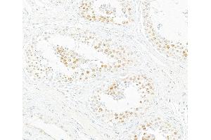 Immunohistochemistry (IHC) image for anti-Bromodomain Containing 7 (BRD7) (AA 601-651) antibody (ABIN7453996) (Recombinant BRD7 antibody  (AA 601-651))