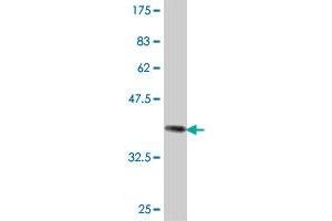 Western Blot detection against Immunogen (37 KDa) . (MTHFD1L antibody  (AA 801-899))